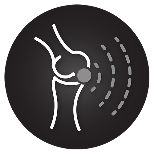 Mild joint inflammation & swelling